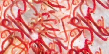 Cách diệt giun đỏ trong nhà vệ sinh hiệu quả nhất